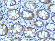 Immunohistochemical analysis of paraffin-embedded Human colon tissue labeling Integrin beta 4 with ab168386 at 1/50 dilution.