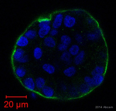 ab133682 staining Integrin beta 4 in human breast epithelail cells by ICC/IF (Immunocytochemistry/immunofluorescence). Cells were fixed with paraformaldehyde, permeabilized with Triton X-100 and blocked with 1% serum for 1 hour at 25°C. Samples were incubated with primary antibody (1/500 in blocking solution) for 1 hour at 25°C. An Alexa Fluor® 488-conjugated goat anti-rabbit IgG polyclonal (1/100) was used as the secondary antibody.See Abreview
