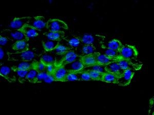 Immunofluorescent analysis of BxPC-3 cells labelling Integrin beta 4 with ab133682 at 1/250 dilution.