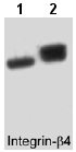 All lanes : Anti-Integrin beta 4 antibody [M126] (ab29042)Lane 1 : A431 (25 µg/lane) serum starved overnightLane 2 : A431 (25 µg/lane) serum treated with pervanadate (1 mM) for 30 min