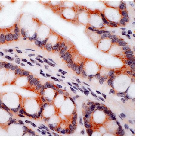 Human small intestine (ab29276) stained with anti-Integrin beta 5 antibody, ab15459 by Immunohistochemistry (FFPE-sections).