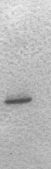 Immunoblot of human interferon-alpha 2b using monoclonal antibody 9D3. Antibody 9D3 at a dilution of 1:1000 (2.5 µg/ml).