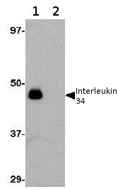 All lanes : Anti-Interleukin 34 antibody (ab74548) at 0.25 µg/mlLane 1 : Human brain tissue lysate, minus immunising peptideLane 2 : Human brain tissue lysate, plus immmunising peptideLysates/proteins at 15 µg per lane.