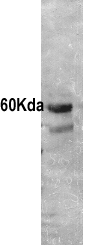 Anti-intestinal alkaline phosphatase antibody (ab7322) at 1/10000 dilution + Alkaline Phosphatase (Human Intestine)SecondaryHRP Goat-a-Rabbit IgG [H&L] at 1/4000 dilutionPerformed under reducing conditions.