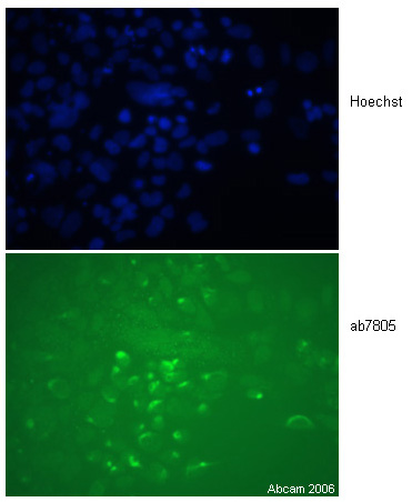 The image shows staining with ab7805 of human embryonic stem cells differentiated into mesendoderm.