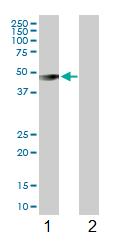 All lanes : Anti-Intrinsic Factor antibody (ab102049) at 1/500 dilutionLane 1 : Intrinsic Factor transfected lysateLane 2 : Non transfected lysateLysates/proteins at 25 µg per lane.developed using the ECL technique