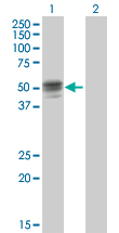 All lanes : Anti-Intrinsic Factor antibody (ab169512) at 1 µg/mlLane 1 : Intrinsic Factor transfected 293T cell lysateLane 2 : Non-transfected 293T cell lysateLysates/proteins at 15 µl per lane.SecondaryGoat Anti-Mouse IgG (H&L)-HRP at 1/2500 dilutiondeveloped using the ECL technique