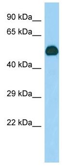 Anti-Intrinsic Factor antibody - C-terminal (ab140352) at 1 µg/ml + Mouse stomach lysate at 10 µg