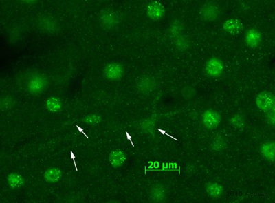 Immunohistochemistical detection of Ionotropic Glutamate receptor 2 using antibody (ab20673) on PFA perfusion-fixed frozen rat brain sections. Primary antibody was used at 1/300, incubated for 18 hours @ 20°C in PBS + 0.3 % Triton X100. Secondary Antibody: Goat anti-rabbit Alexa Fluor® 488 (1/1000). The image demonstrates immunostaining obtained in the rat cortex, thin and punctuated cytoplasmic staining is observed as previously described for the hippocampus (J neurosci 2003 Nov 1923(33):10521-30). There is some staining in cellular processes as well (arrows).See Abreview