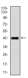 Anti-Ionotropic Glutamate receptor 2 antibody [7G6] (ab135367) at 1/500 dilution + Ionotropic Glutamate receptor 2 recombinant protein
