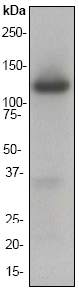 Anti-Ionotropic Glutamate receptor 2 antibody [EP966Y] (ab52932) at 1/2000 dilution + Human brain cell lysate at 10 µgSecondaryGoat anti-Rabbit HRP labeled at 1/2000 dilution