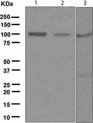 All lanes : Anti-Ionotropic Glutamate receptor 4 antibody [EPR2511(2)] (ab119995) at 1/1000 dilutionLane 1 : Rat Brain lysateLane 2 : Mouse Brain lysateLane 3 : Human Brain lysateLysates/proteins at 10 µg per lane.SecondaryHRP labelled goat anti-rabbit at 1/2000 dilution