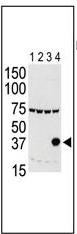 All lanes : Anti-IPL-1/STK13/Aurora C antibody (ab38299) at 1/500 dilutionLane 1 : 293 cell lysate expressing Flag tagLane 2 : 293 cell lysate expressing Flag tag Aurora A Lane 3 : 293 cell lysate expressing Flag tag Aurora BLane 4 : 293 cell lysate expressing Flag tag Aurora C