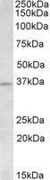 Anti-IPL-1/STK13/Aurora C antibody (ab99492) at 1.5 µg/ml + Human Testis lysate at 35 µgdeveloped using the ECL technique