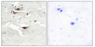 Immunohistochemical analysis of paraffin-embedded Human brain tissue labeling IPPK with ab196781 at 1/50 dilution. The image on the right is pre-incubated with synthesized peptide.
