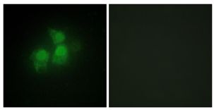 Immunoflourescent analysis of HepG2 cells labeling IPPK with ab196781 at 1/100 dilution. The image on the right is pre-incubated with synthesized peptide.