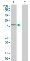 All lanes : Anti-IQCD antibody (ab67920) at 1/500 dilutionLane 1 : IQCD transfected 293T cell lysateLane 2 : Non transfected 293T cell lysateLysates/proteins at 25 µg per lane.SecondaryGoat anti-mouse IgG (H&L)-HRP conjugate at 1/2500 dilution