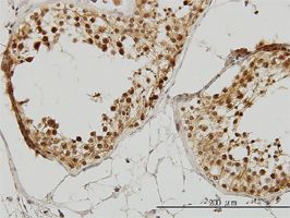 IRAK antibody (ab55316) used in immunohistochemistry at 3ug/ml on formalin fixed and paraffin embedded human testis.