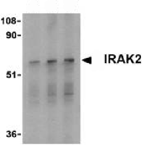 Lane 1 :  Anti-IRAK2 antibody (ab62419) at 0.5 µg/mlLane 2 :  Anti-IRAK2 antibody (ab62419) at 1 µg/mlLane 3 :  Anti-IRAK2 antibody (ab62419) at 2 µg/mlLane 1 : RAW264.7 whole cell lysateLane 2 : RAW264.7 whole cell lysateLane 3 : RAW264.7 whole cell lysateLysates/proteins at 15 µg per lane.