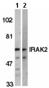 All lanes : Anti-IRAK2 antibody (ab6148) at 2 µg/mlLane 1 : HeLa whole cell lysateLane 2 : K562 whole cell lysate