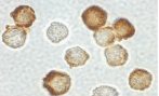 ab6148 at 2µg/ml staining IRAK2 in Hela cells by ICC/IF