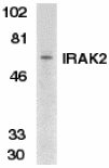 Anti-IRAK2 antibody (ab6158) at 1/500 dilution + K562 whole cell lysateObserved band size : 65 kDa (why is the actual band size different from the predicted?)