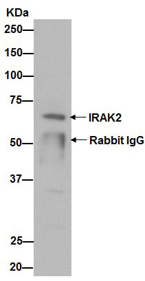 Western blot analysis of IRAK2 in MOLT4 cell lysates immunoprecipitated using ab192249 at 1/60 dilution. Secondary antibody: Goat Anti-Rabbit IgG, (H+L), Peroxidase conjugated at 1/1000 dilution.Blocking/Dilution buffer: 5% NFDM /TBST.