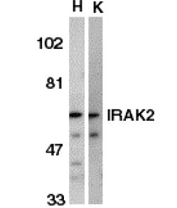 All lanes : Anti-IRAK2 antibody - Carboxyterminal end (ab47995) at 1/500 dilutionLane 1 : (H): HeLa whole cell lysates.Lane 2 : (K): K562 whole cell lysates.Lysates/proteins at 15 µg per lane.