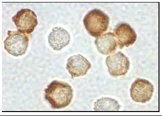 Staining of IRAK-2 in HeLa cells. The cells were fixed with paraformaldehyde and reacted with the primary antibody ab47995 diluted at 1:500.
