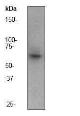 Anti-IRAKM antibody [Y278] (ab32394) at 1/20000 dilution + A431 cell lysate