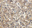 ab8116 at 2µg/ml staining IRAKM in rat liver cells by IHC  