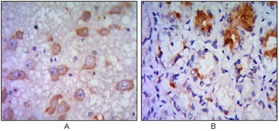 Immunohistochemical analysis of paraffin-embedded Human brain tissue (A) and stomach tissue (B), showing cytoplasmic localization using ab96481 at 1/200 dilution with DAB staining.