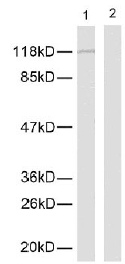 All lanes : Anti-NFkB p105 / p50 (phospho S337) antibody (ab28849)Lane 1 : Untreated extracts from MDA-MB-435 cells (5-30ug).Lane 2 : Extracts from MDA-MB-435 cells (5-30ug) treated with synthesized phosphopeptide.
