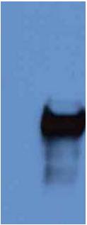 All lanes : Anti-PFD1145c antibody (ab52699) at 1/1000 dilutionLane 1 : ~20µg of a total protein extract from E coli with ~50ng to 100ng of a recombinant fusion protein of an irrelevant antigenLane 2 : ~20µg of a total protein extract from E coli with ~50ng to 500ng of the antigen (recombinant fusion protein containing a His tag)SecondaryRabbit anti-mouse IgG + IgM, (H+L) horseradish peroxidase conjugated at 1/5000 dilution