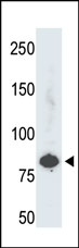 Anti-PFKL antibody (ab37583) at 1/100 dilution + HepG2 cell lysate