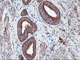 ab119796 at 1/150 dilution staining PFKP in Paraffin-embedded Human Endometrium tissue by Immunohistochemistry.
