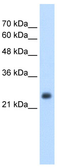 Anti-NNMT antibody (ab58743) at 1/2.5 dilution + HepG2 cell lysate at 10 µg with skim milk/PBS buffer at 5 %SecondaryHRP conjugated anti-Rabbit IgG at 1: 50,000 - 100,000