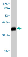Western blot against tagged recombinant protein immunogen using ab55224 PGCD antibody at 1ug/ml.