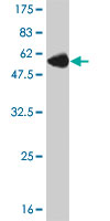 Western blot against tagged recombinant protein immunogen using ab55785 NNMT antibody at 1ug/ml.