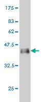 Western blot against tagged recombinant protein immunogen using ab57020 PGEA1 antibody at 1ug/ml.