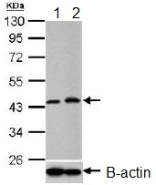 All lanes : Anti-PGK1 antibody (ab154613) at 1/1000 dilutionLane 1 : HeLa whole cell lysate (untreated)Lane 2 : HeLa whole cell lysate (1% O2 treatment for 24hr)Lysates/proteins at 30 µg per lane.