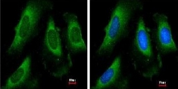 Immunofluorescence analysis of methanol-fixed HeLa cells, labeling PGK1 using ab154613 at 1/50 dilution. Right panel costained with Hoechst 33342.