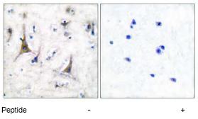 ab53057, at a dilution of 1/50, staining paraffin embedded human brain tissue sections by Immunohistochemistry. Left image: no immunising peptide  Right image: immunising peptide present