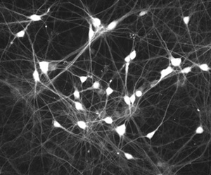 ab8189 (1/20) immunostaining neurons in mouse cortical primary cell culture.
