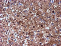 ab119758 at 1/150 dilution, staining NNMT in paraffin-embedded Human liver tissue by Immunohistochemistry.