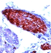 IHC-P using ab15504