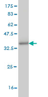 Western blot against tagged recombinant protein immunogen using ab57870 PHACS antibody at 1ug/ml.