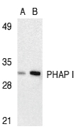 Western blot analysis of PHAP I expression in human Raji cell lysate with anti-PHAP I at 2 µg/ml (lane A) and 4 µg/ml (lane B), respectively. 