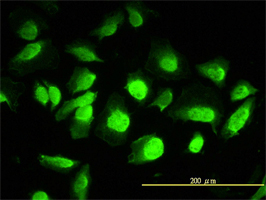 PHAP1 antibody (ab56429) used in immunofluorescence at 1-5ug/ml on HeLa cells.