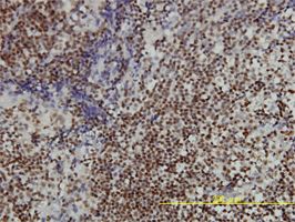 PHAP1 antibody (ab56429) used in immunohistochemistry at 3ug/ml on formalin fixed and paraffin embedded human tonsil tissue.